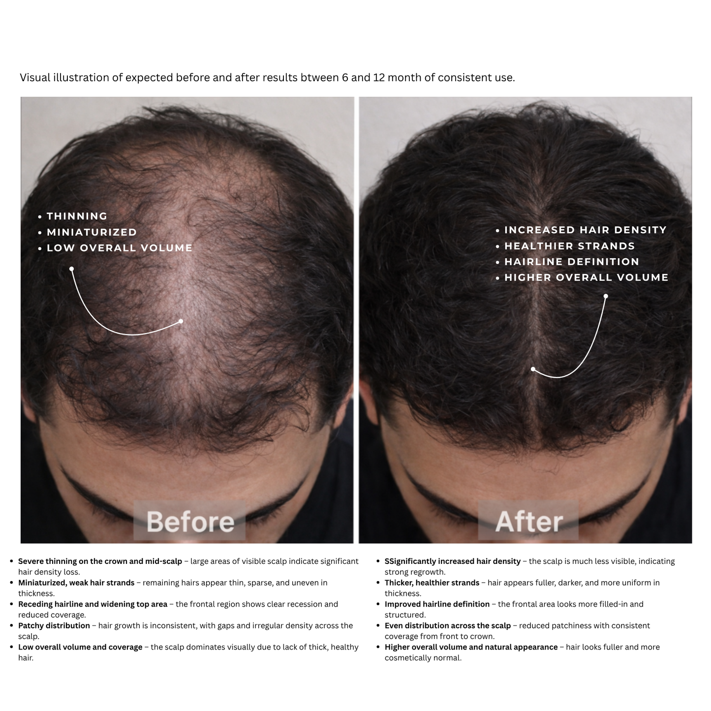 Avera Hair Vitality Peptide