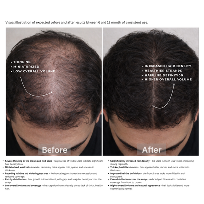 Avera Hair Vitality Peptide